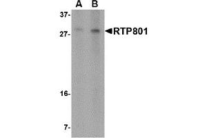 Western Blotting (WB) image for anti-DNA-Damage-Inducible Transcript 4 (DDIT4) (N-Term) antibody (ABIN1031547)