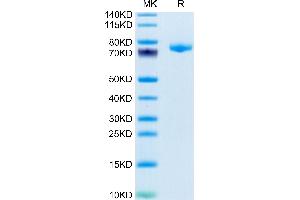 Mouse DSG3 on Tris-Bis PAGE under reduced condition. (Desmoglein 3 Protein (DSG3) (AA 50-617) (His tag))