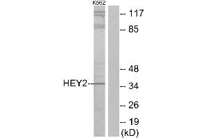 Western blot analysis of extracts from K562 cells, using HEY2 antibody. (HEY2 Antikörper)