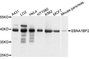 Western blot analysis of extracts of various cell lines, using EBNA1BP2 antibody. (EBNA1BP2 Antikörper)