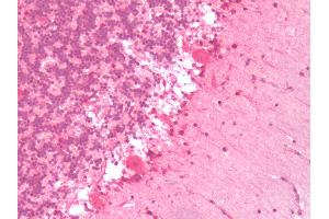 Human Brain, Cerebellum: Formalin-Fixed, Paraffin-Embedded (FFPE) (Serotonin Receptor 6 Antikörper  (C-Term))