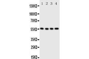 Anti-Glucose Transporter 5 GLUT5 antibody, Western blotting Lane 1: U87 Cell Lysate Lane 2: 293T Cell Lysate Lane 3:  Cell Lysate Lane 4: SW620 Cell Lysate (SLC2A5 Antikörper  (C-Term))