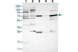 Western blot analysis of Lane 1: RT-4, Lane 2: U-251 MG, Lane 3: Human Plasma, Lane 4: Liver, Lane 5: Tonsil with NUDCD1 polyclonal antibody  at 1:250-1:500 dilution. (NUDCD1 Antikörper)