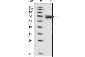 Western blot analysis using FGFR1 mouse mAb against extracellular domain of human FGFR1 (aa22-376).