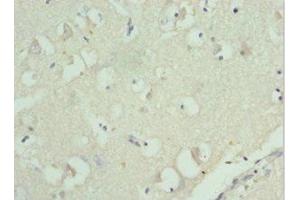 Immunohistochemistry of paraffin-embedded human brain tissue using ABIN7142845 at dilution of 1:100 (RPL9 Antikörper  (AA 1-192))