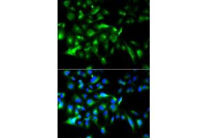 Immunofluorescence analysis of HeLa cell using MYD88 antibody. (MYD88 Antikörper  (AA 60-309))