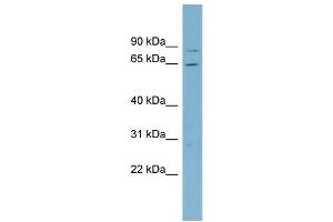 WB Suggested Anti-RPA1  Antibody Titration: 0. (RPA1 Antikörper  (Middle Region))