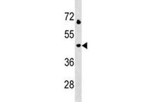 LAMP3 antibody western blot analysis in Jurkat lysate.