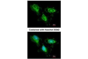 ICC/IF Image Immunofluorescence analysis of methanol-fixed HeLa, using Fumarate hydratase, antibody at 1:200 dilution. (FH Antikörper)