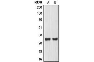 Western blot analysis of TCFL4 expression in LOVO (A), mouse placenta (B) whole cell lysates. (MLX Antikörper  (Center))