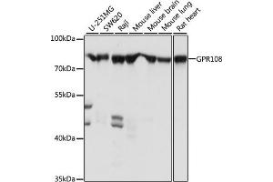 Western blot analysis of extracts of various cell lines, using GPR108 antibody (ABIN7267291) at 1:1000 dilution. (GPR108 Antikörper  (AA 33-260))