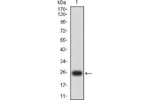 Western blot analysis using MLH1 mAb against human MLH1 (AA: 381-483) recombinant protein. (MLH1 Antikörper  (AA 381-483))