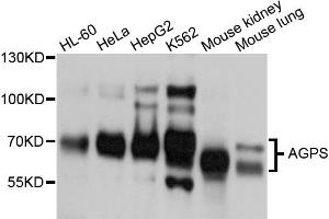 Western blot analysis of extracts of various cell lines, using AGPS antibody. (AGPS Antikörper)