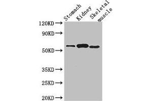 Western Blot Positive WB detected in: Mouse stomach tissue, Mouse kidney tissue, Mouse skeletal muscle tissue All lanes: PPM1H antibody at 3. (PPM1H Antikörper  (AA 73-289))