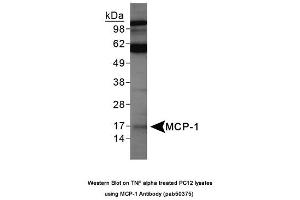 Image no. 1 for anti-Chemokine (C-C Motif) Ligand 2 (CCL2) (AA 15-40) antibody (ABIN363682) (CCL2 Antikörper  (AA 15-40))