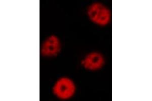 ABIN6269187 staining Hela by IF/ICC. (EIF2AK2 Antikörper  (Internal Region))