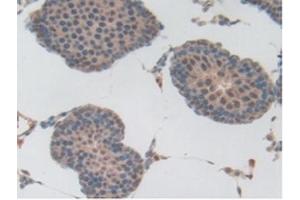 Detection of Plg in Rat Testis Tissue using Polyclonal Antibody to Plasminogen (Plg) (PLG Antikörper  (AA 191-433))