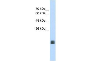 MGC33926 antibody used at 1. (TMEM178 Antikörper  (Middle Region))