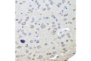 Immunohistochemistry of paraffin-embedded mouse brain using CHRNB2 antibody at dilution of 1:100 (x40 lens). (CHRNB2 Antikörper)