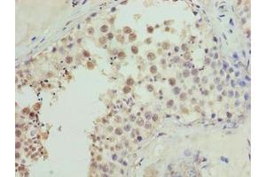 Immunohistochemistry of paraffin-embedded human testis tissue using ABIN7149078 at dilution of 1:100 (CDADC1 Antikörper  (AA 1-99))