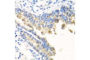 Immunohistochemistry of paraffin-embedded mouse lung using NYX antibody at dilution of 1:100 (40x lens).