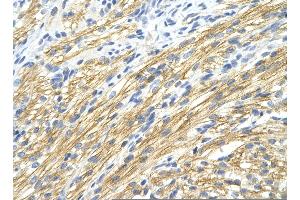 Rabbit Anti-MBNL1 Antibody       Paraffin Embedded Tissue:  Human cardiac cell   Cellular Data:  Epithelial cells of renal tubule  Antibody Concentration:   4. (MBNL1 Antikörper  (Middle Region))