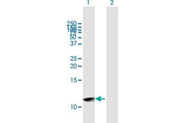 Urotensin 2B Antikörper  (AA 1-119)