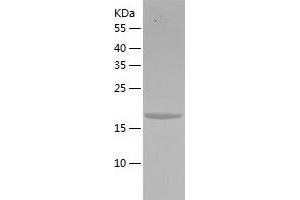 Western Blotting (WB) image for NTF2-Related Export Protein 1 (NXT1) (AA 1-160) protein (His tag) (ABIN7124198) (NXT1 Protein (AA 1-160) (His tag))