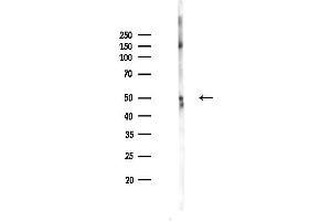 anti-Inositol-Trisphosphate 3-Kinase A (ITPKA) (N-Term) antibody
