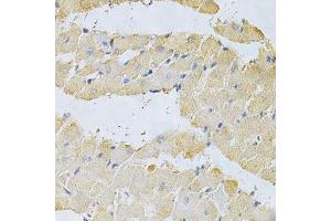 Immunohistochemistry of paraffin-embedded rat heart using PPA1 Antibody. (Pyrophosphatase (Inorganic) 1 (PPA1) (AA 1-289) Antikörper)