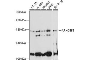 Western blot analysis of extracts of various cell lines, using  antibody (ABIN6129195, ABIN6137096, ABIN6137097 and ABIN6220538) at 1:3000 dilution. (ARHGEF5 Antikörper  (AA 1248-1597))