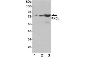 Western blot testing of 1) human C2C12, 2) monkey COS7 and 3) rat C6 cell lysates using PKC alpha antibody at 1:1000. (PKC alpha Antikörper)