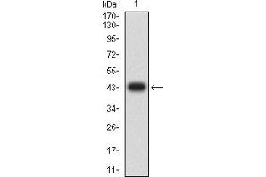 Western blot analysis using IL1B mAb against human IL1B (AA: 117-269) recombinant protein. (IL-1 beta Antikörper  (AA 117-269))
