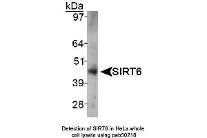 Image no. 1 for anti-Sirtuin 6 (SIRT6) (AA 250-350), (Internal Region) antibody (ABIN363527) (SIRT6 Antikörper  (Internal Region))