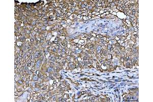 IHC analysis of EPLIN/LIMA1 using anti-EPLIN/LIMA1 antibody (ABIN7602639). (LIMA1 Antikörper  (AA 9-744))