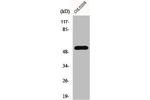 Western Blot analysis of COLO205 cells using HisRS Polyclonal Antibody (HARS1/Jo-1 Antikörper  (C-Term))
