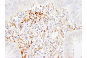 Immunohistochemistry (IHC) image for anti-Filamin A, alpha (FLNA) (AA 400-450) antibody (ABIN7454529) (Filamin A Antikörper  (AA 400-450))