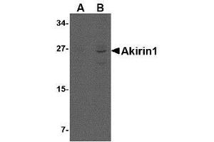 Western blot analysis of Akirin1 in rat liver lysate with AP30039PU-N Akirin1 antibody at (A) 1 and (B) 2 μg/ml. (Akirin 1 Antikörper  (Center))