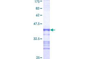 PAK2 Protein (AA 131-230) (GST tag)