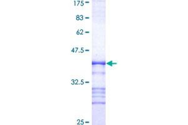 PAK2 Protein (AA 131-230) (GST tag)