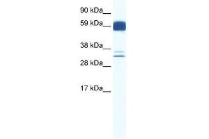ZIC5 antibody used at 0. (ZIC5 Antikörper  (N-Term))