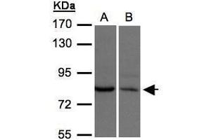 WB Image Sample(30 μg of whole cell lysate) A:H1299 B:Hep G2, 7. (xpr1 Antikörper  (N-Term))