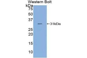 Detection of Recombinant C2, Human using Polyclonal Antibody to Complement Component 2 (C2) (Complement C2 Antikörper  (AA 245-451))