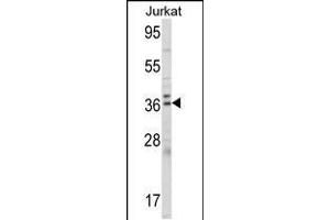 ALAD Antikörper  (C-Term)