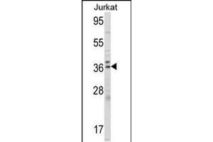 Western blot analysis of ALAD Antibody (C-term) (ABIN390809 and ABIN2841046) in Jurkat cell line lysates (35 μg/lane). (ALAD Antikörper  (C-Term))