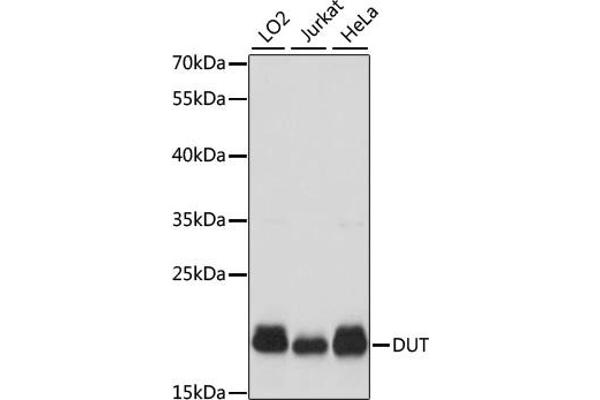 Deoxyuridine Triphosphatase (DUT) (AA 89-252) Antikörper