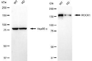 Western blotting analysis using ROCK1 antibody (ABIN7800201). (Rekombinanter ROCK1 Antikörper)
