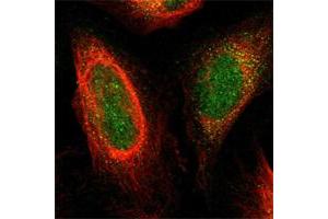 Immunofluorescent staining of human cell line U-2 OS shows positivity in nucleus & cytoplasm. (Plexin A1 Antikörper)