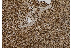 ABIN6261480 and ABIN6279422 at 1/100 staining Mouse spleen tissue by IHC-P. (EIF3A Antikörper  (C-Term))