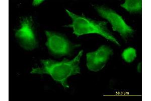 Immunofluorescence of monoclonal antibody to B2M on HeLa cell.